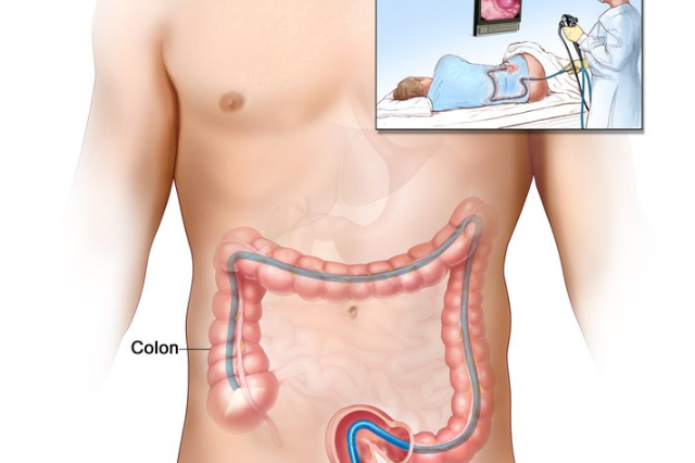 Colonoscopy – Why indicated? and how to prepare?